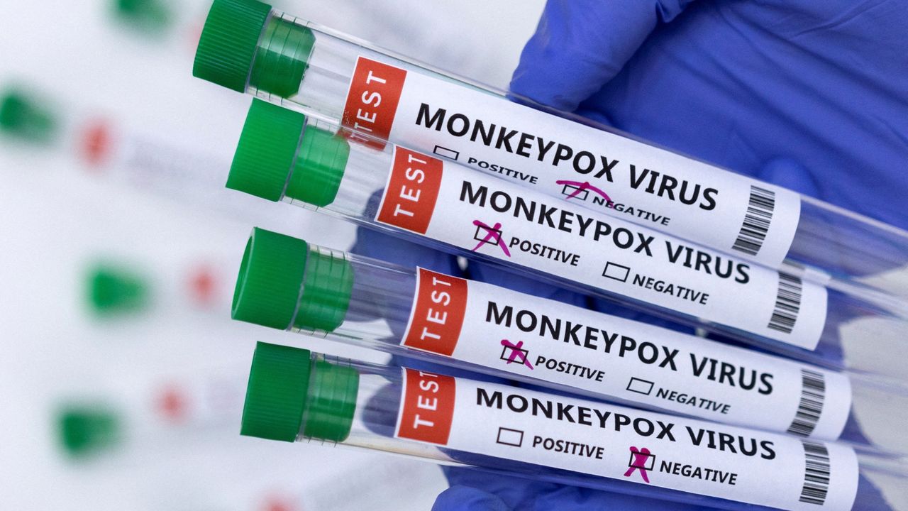 DSÖ: Toplu Maymun Çiçeği Aşısına İhtiyaç Yok