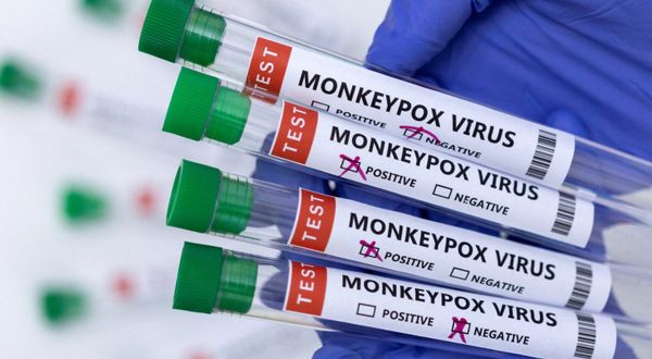 DSÖ: Toplu Maymun Çiçeği Aşısına İhtiyaç Yok